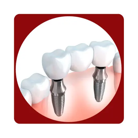 Para iniciar el proceso de fresado, sigue estos pasos:

 	Ingresa el nombre y el documento del paciente.
 	Especifica la fecha de entrega.
 	Selecciona el material.
 	Selecciona las piezas dentales a tratar
 	Selecciona el color según la guía correspondiente.
 	Una vez completada la selección, sube el archivo CAD/CAM para finalizar el pedido.

Este flujo garantiza precisión y rapidez en el proceso, optimizando la entrega de tu pedido.