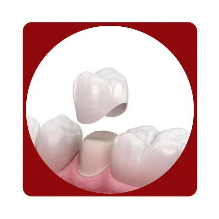 Para iniciar el proceso de fresado con tecnología CAD/CAM, sigue estos pasos:

 	Ingresa el nombre y el documento del paciente.
 	Especifica la fecha de entrega.
 	Selecciona el material.
 	Selecciona las piezas dentales a tratar
 	Selecciona el color según la guía correspondiente.
 	Una vez completada la selección, sube el archivo CAD/CAM para finalizar el pedido.

Este flujo garantiza precisión y rapidez en el proceso, optimizando la entrega de tu pedido.