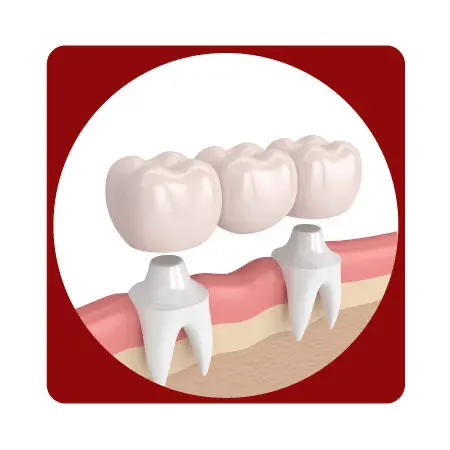 Para iniciar el proceso de fresado con tecnología CAD/CAM, sigue estos pasos:

 	Ingresa el nombre y el documento del paciente.
 	Especifica la fecha de entrega.
 	Selecciona el material.
 	Selecciona las piezas dentales a tratar
 	Selecciona el color según la guía correspondiente.
 	Una vez completada la selección, sube el archivo CAD/CAM para finalizar el pedido.

Este flujo garantiza precisión y rapidez en el proceso, optimizando la entrega de tu pedido.