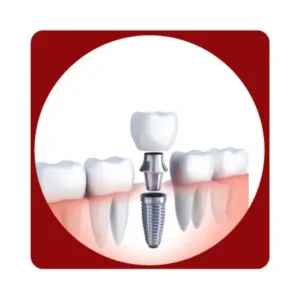 Implantes Unidad