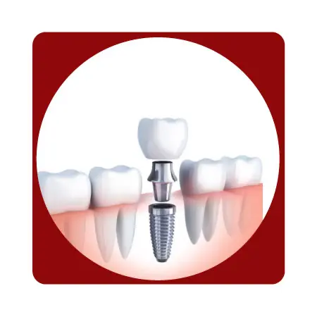 Para iniciar el proceso de fresado con tecnología CAD/CAM, sigue estos pasos:

 	Ingresa el nombre y el documento del paciente.
 	Especifica la fecha de entrega.
 	Selecciona el material.
 	Selecciona las piezas dentales a tratar
 	Selecciona el color según la guía correspondiente.
 	Una vez completada la selección, sube el archivo CAD/CAM para finalizar el pedido.

Este flujo garantiza precisión y rapidez en el proceso, optimizando la entrega de tu pedido.